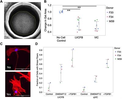 Identifying molecular and functional similarities and differences between human primary cardiac valve interstitial cells and ventricular fibroblasts